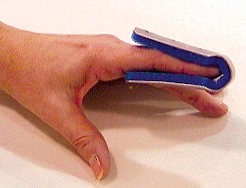 Fold Over Finger Splint Medium Bulk  Pk-6 Non-retail