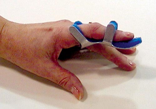 Toad Finger Splint Small Bulk  Pk-6 Non-retail