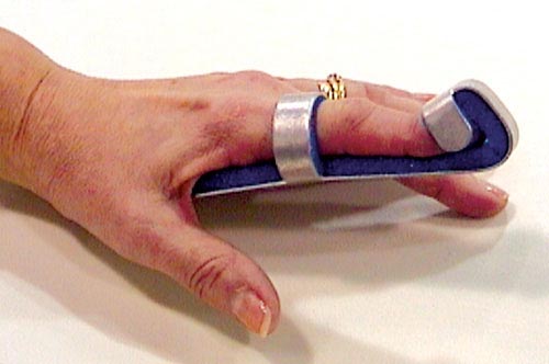 Baseball Finger Splint Small Bulk  Pk-6 Non-retail