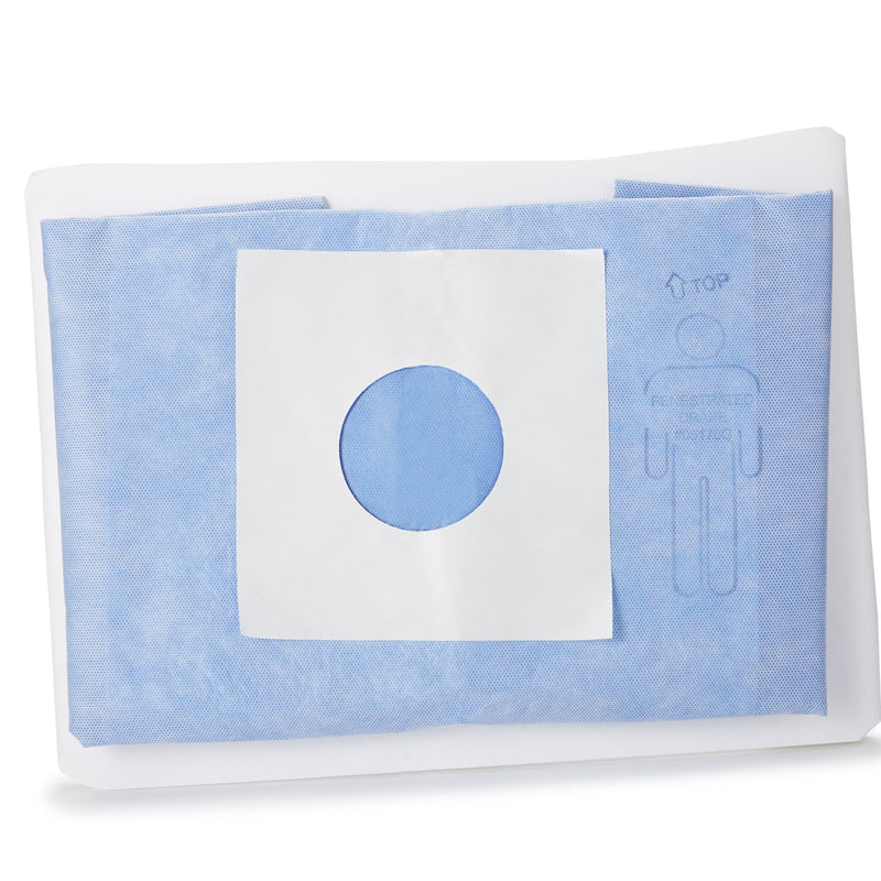 McKesson Sterile Minor Procedure Surgical Drape, 48 W x 60 L Inch