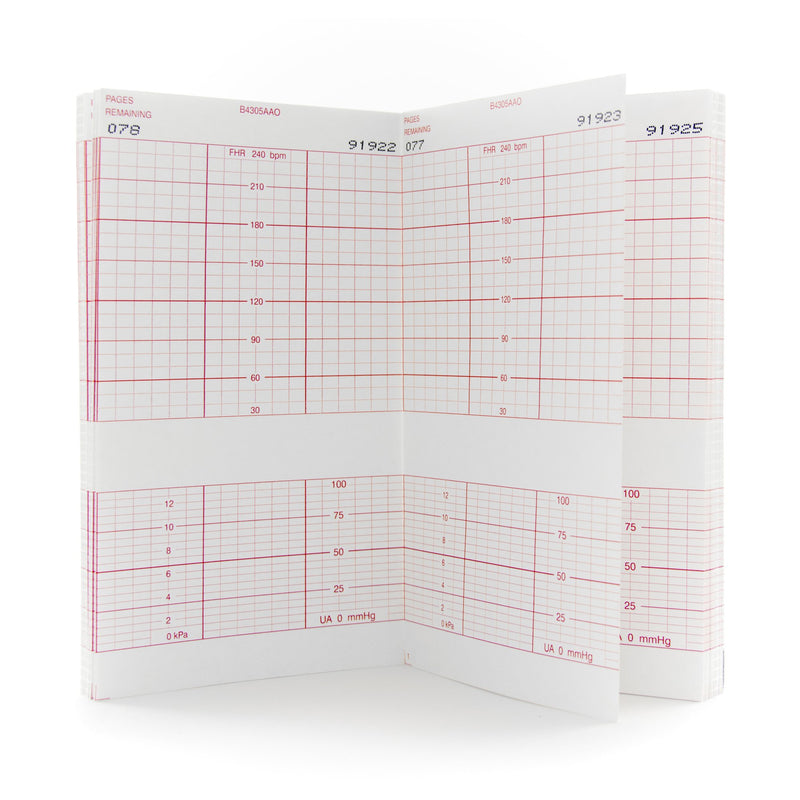 McKesson Fetal Monitoring Paper