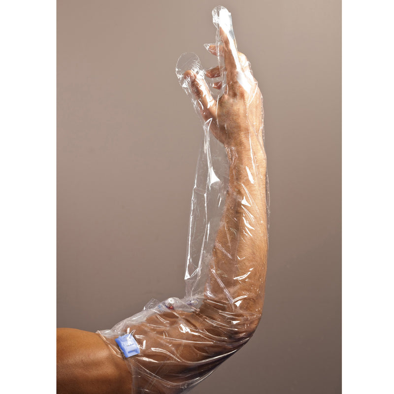 AquaGuard Glove® Wound Protector, 34 Inch