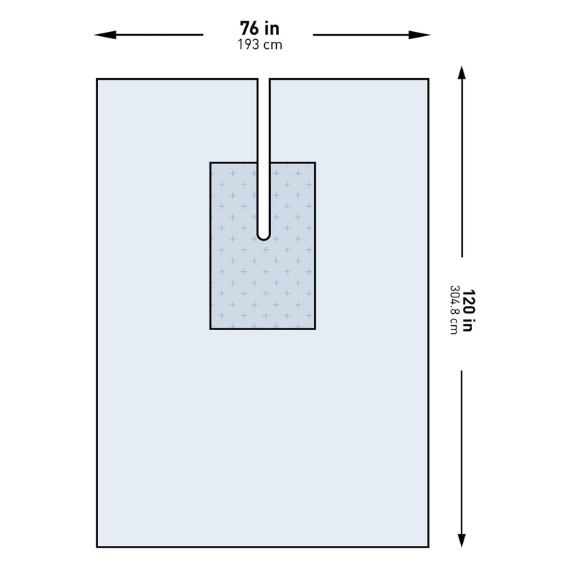 McKesson Sterile Orthopedic U-Drape, 76 W x 120 L Inch