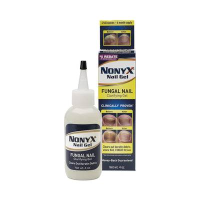NonyX Ethanoic Acid Antifungal, 4 oz. Bottle
