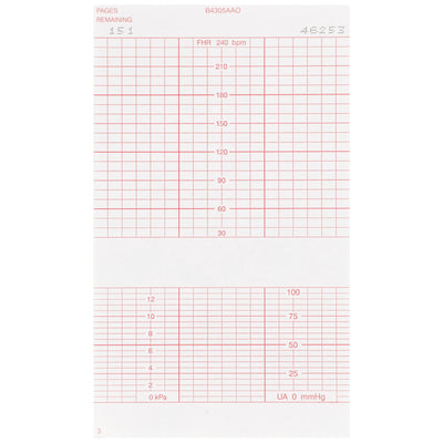 McKesson Fetal Monitoring Paper