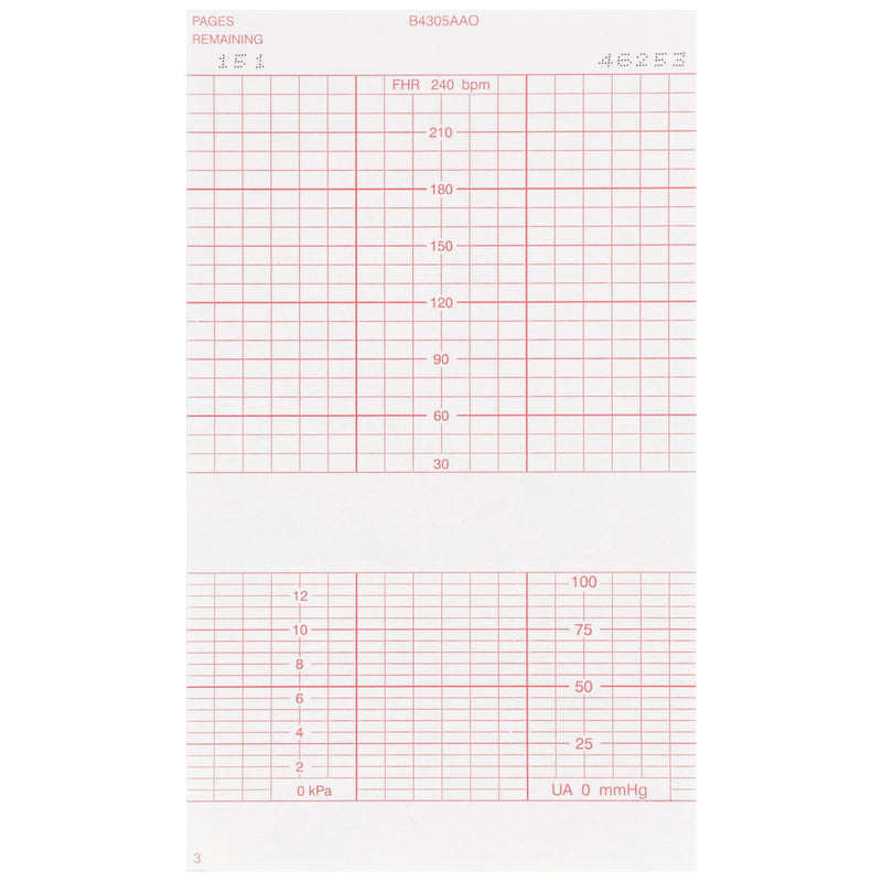 McKesson Fetal Monitoring Paper